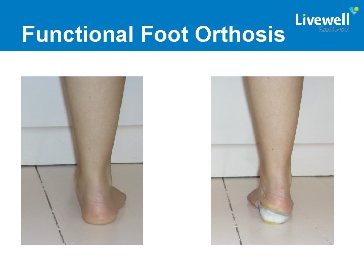 Functional Foot Orthosis 