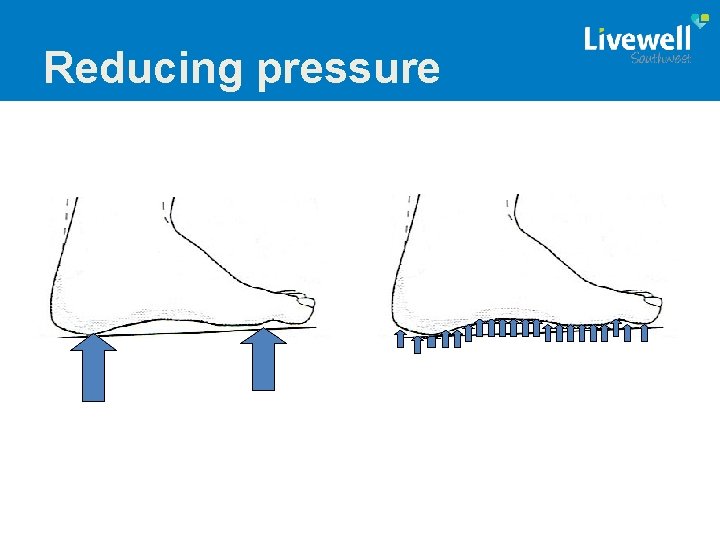 Reducing pressure 