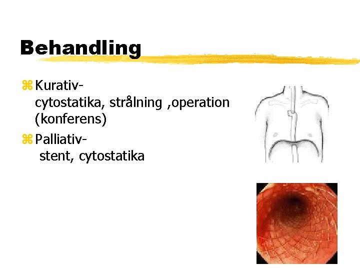 Behandling Kurativcytostatika, strålning , operation (konferens) Palliativstent, cytostatika 