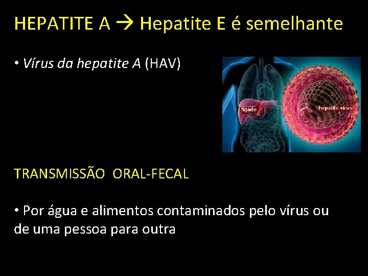 HEPATITE A Hepatite E é semelhante • Vírus da hepatite A (HAV) TRANSMISSÃO ORAL-FECAL