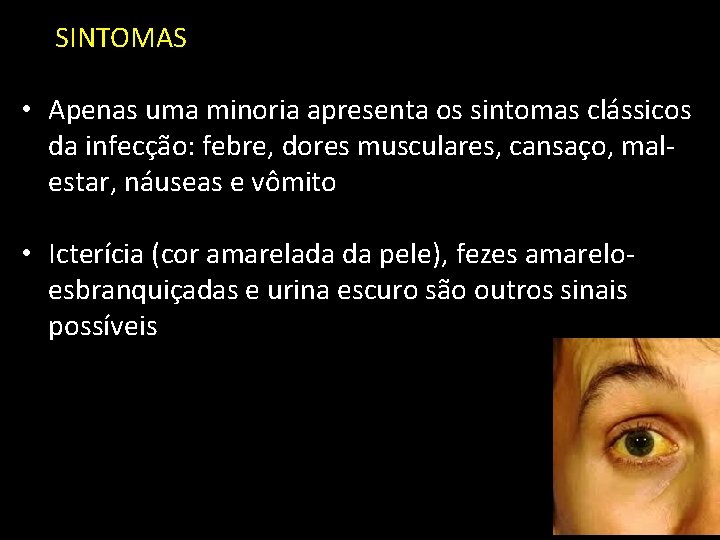 SINTOMAS • Apenas uma minoria apresenta os sintomas clássicos da infecção: febre, dores musculares,