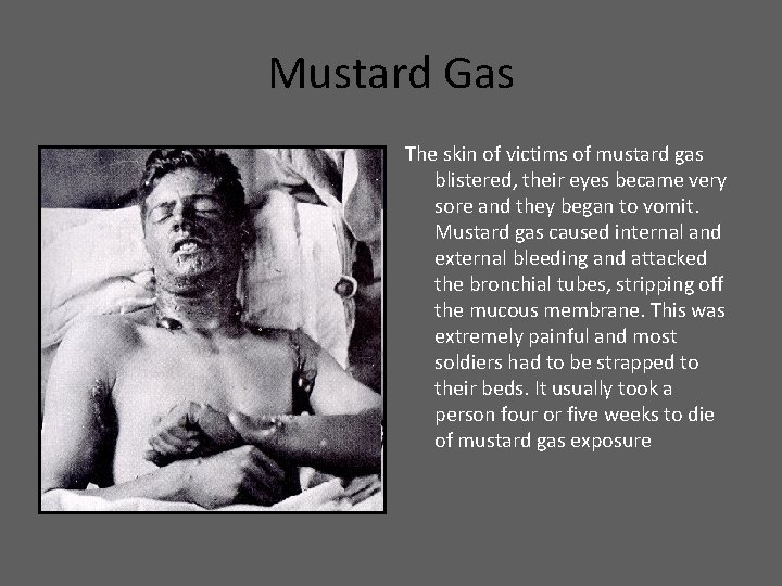 Mustard Gas The skin of victims of mustard gas blistered, their eyes became very