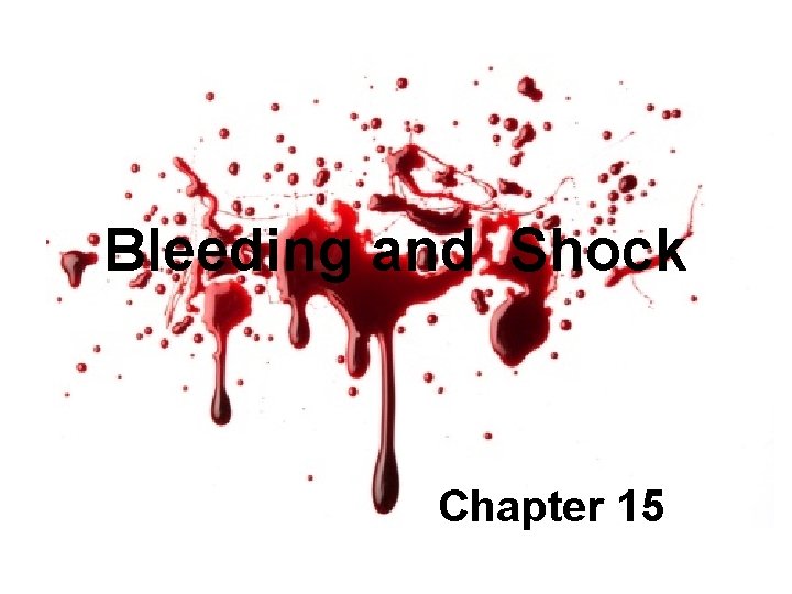 Bleeding and Shock Chapter 15 