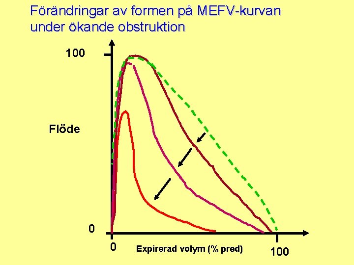 Förändringar av formen på MEFV-kurvan under ökande obstruktion 100 Flöde 0 0 Expirerad volym