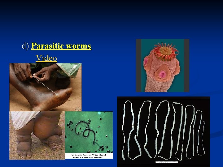 d) Parasitic worms Video 