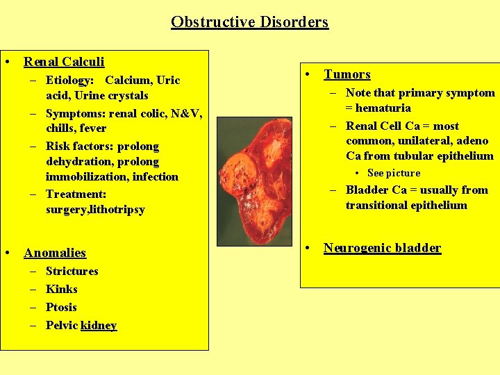 Obstructive Disorders • Renal Calculi – Etiology: Calcium, Uric acid, Urine crystals – Symptoms: