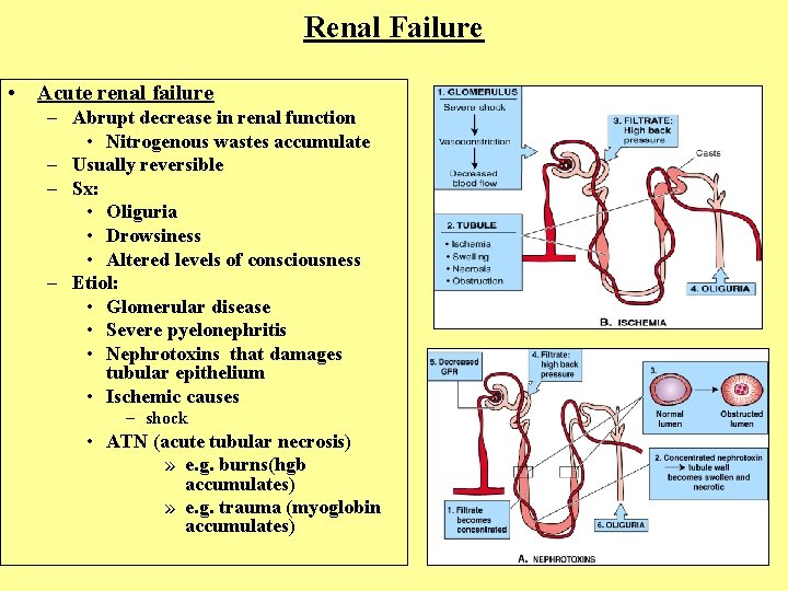 Renal Failure • Acute renal failure – Abrupt decrease in renal function • Nitrogenous