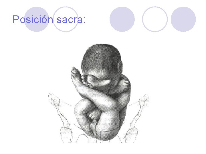 Posición sacra: 