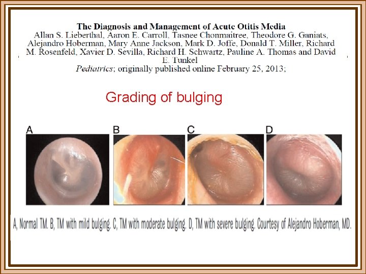 Grading of bulging 