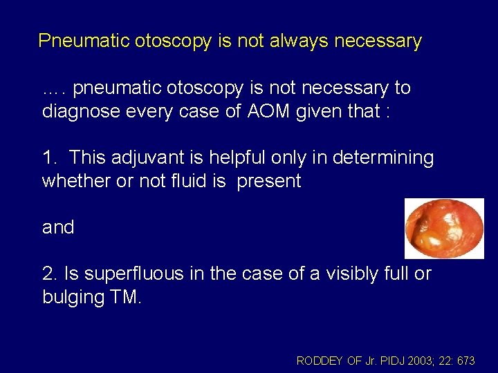 Pneumatic otoscopy is not always necessary …. pneumatic otoscopy is not necessary to diagnose