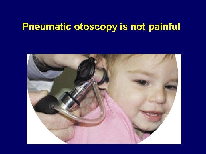 Pneumatic otoscopy is not painful 