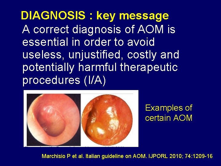 DIAGNOSIS : key message A correct diagnosis of AOM is essential in order to