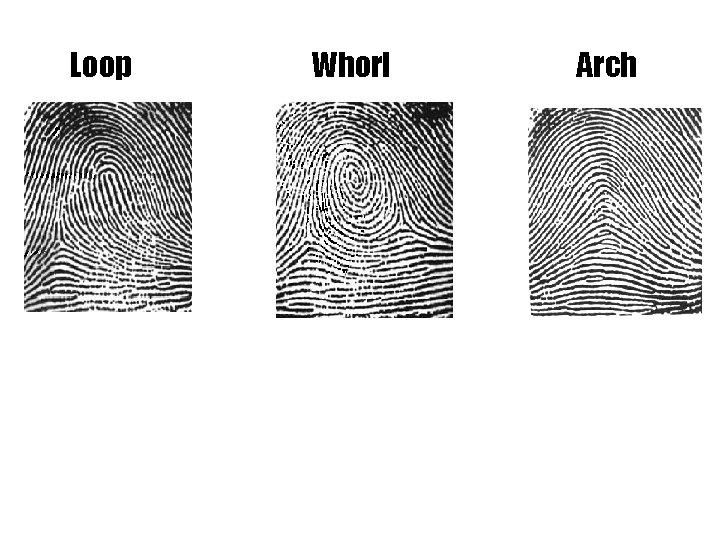 Loop Whorl Arch 