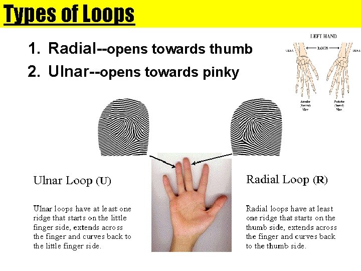 Types of Loops 1. Radial--opens towards thumb 2. Ulnar--opens towards pinky 