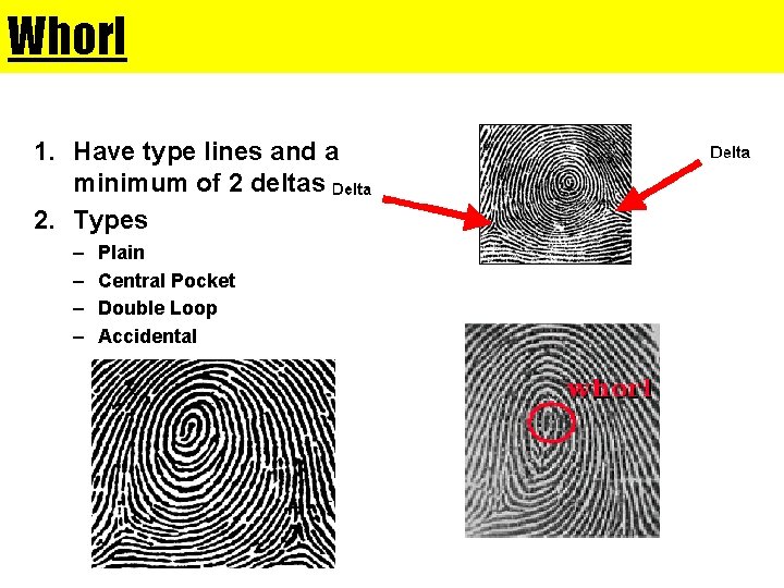 Whorl 1. Have type lines and a minimum of 2 deltas 2. Types –