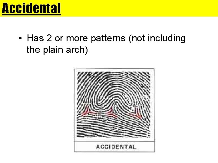 Accidental • Has 2 or more patterns (not including the plain arch) 