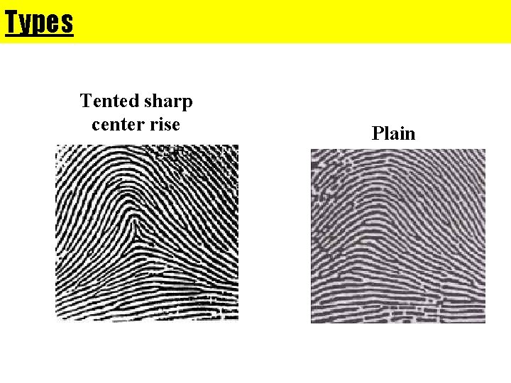 Types Tented sharp center rise Plain Types Tented sharp center rise Plain