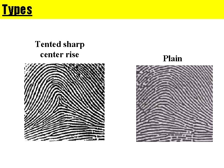 Types Tented sharp center rise Plain 