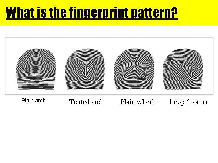 What is the fingerprint pattern? Plain arch Tented arch Plain whorl Loop (r or