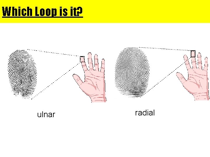 Which Loop is it? ulnar radial 