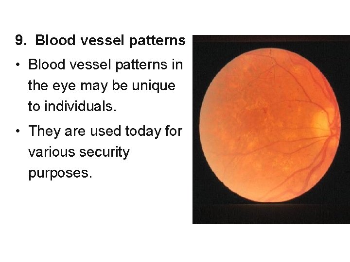 9. Blood vessel patterns • Blood vessel patterns in the eye may be unique