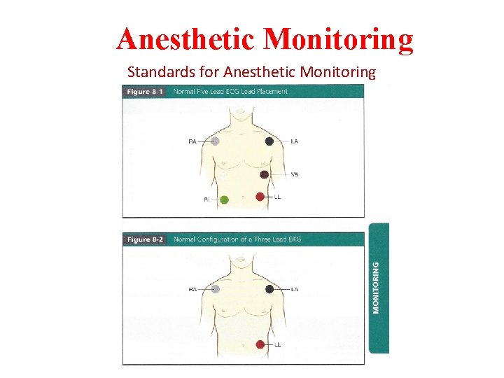 Anesthetic Monitoring Standards for Anesthetic Monitoring 