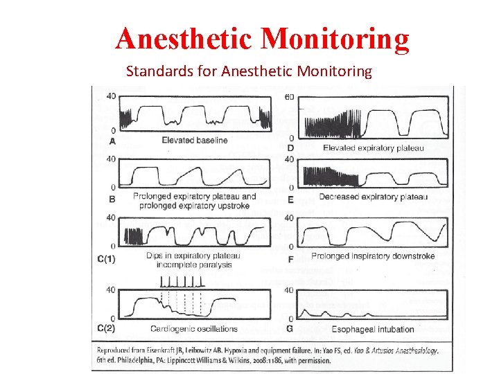 Anesthetic Monitoring Standards for Anesthetic Monitoring 