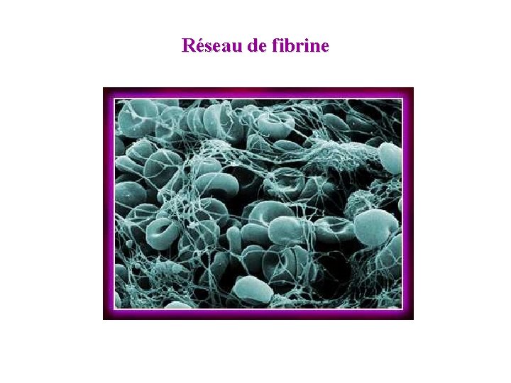 Réseau de fibrine 
