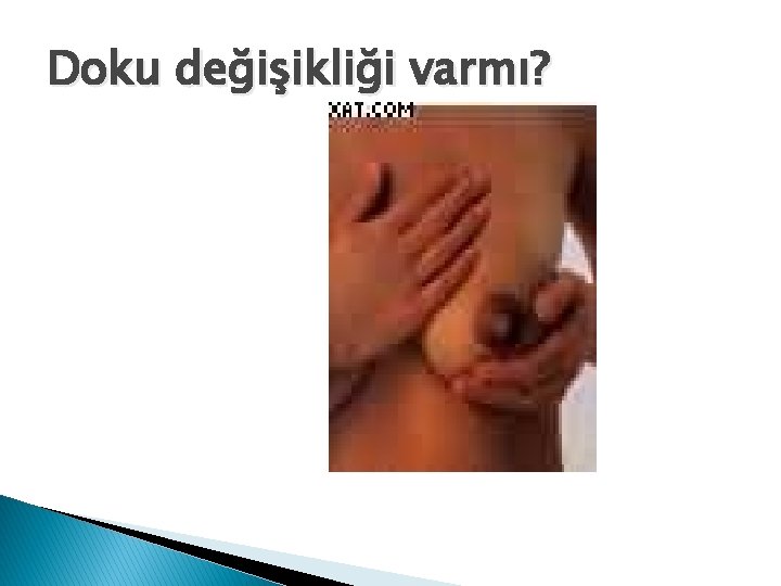 Doku değişikliği varmı? 