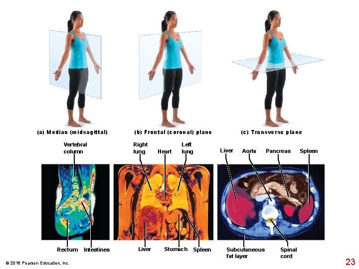 (a) Median (midsagittal) Vertebral column Rectum © 2018 Pearson Education, Inc. Intestines (b) Frontal