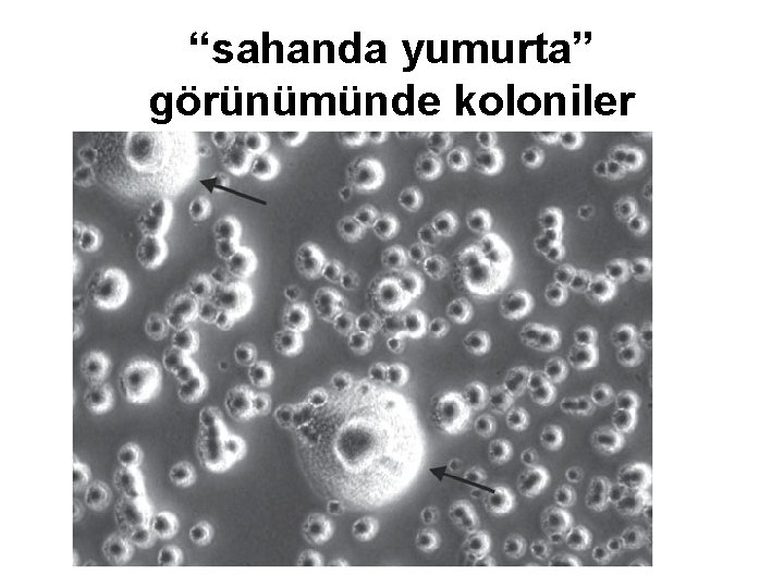 “sahanda yumurta” görünümünde koloniler 