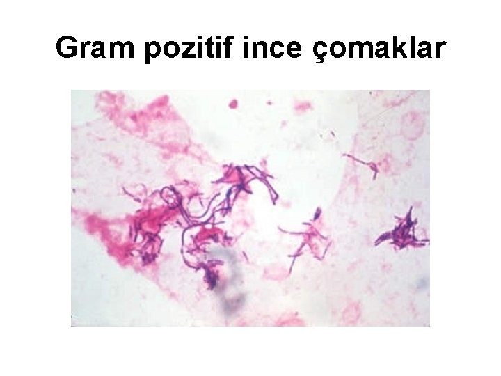 Gram pozitif ince çomaklar 