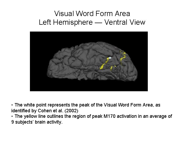 Visual Word Form Area Left Hemisphere — Ventral View • The white point represents