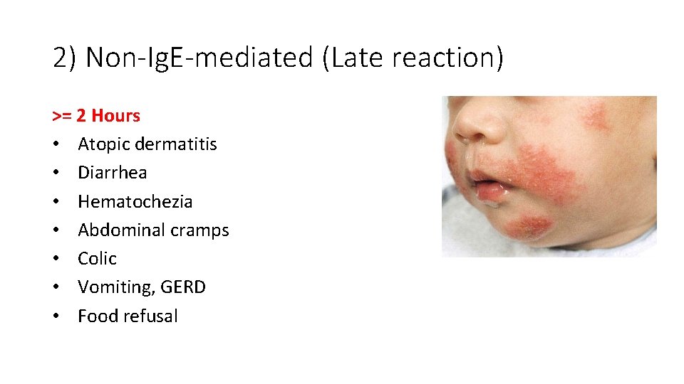 2) Non-Ig. E-mediated (Late reaction) >= 2 Hours • Atopic dermatitis • Diarrhea •
