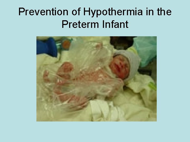 Prevention of Hypothermia in the Preterm Infant 