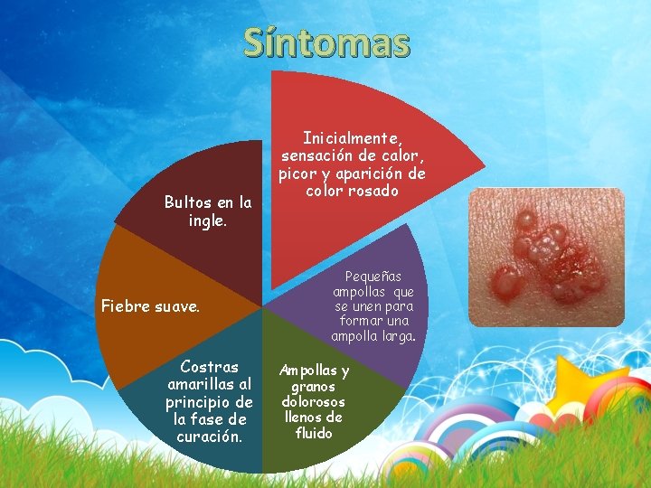 Síntomas Bultos en la ingle. Fiebre suave. Costras amarillas al principio de la fase