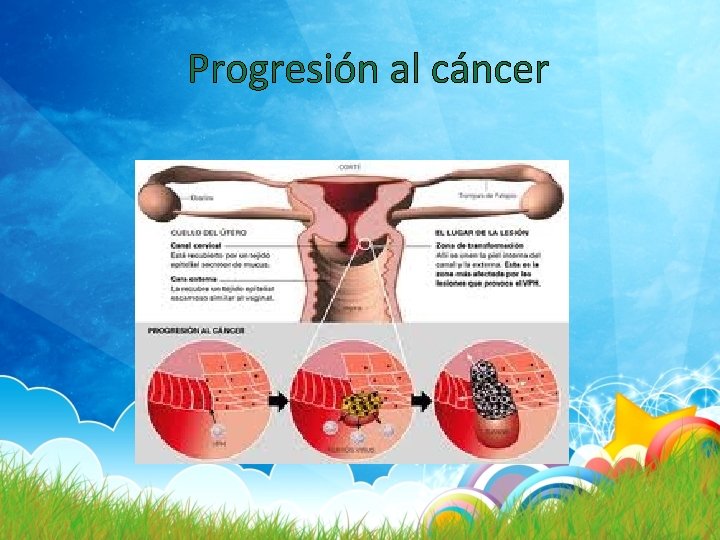 Progresión al cáncer 