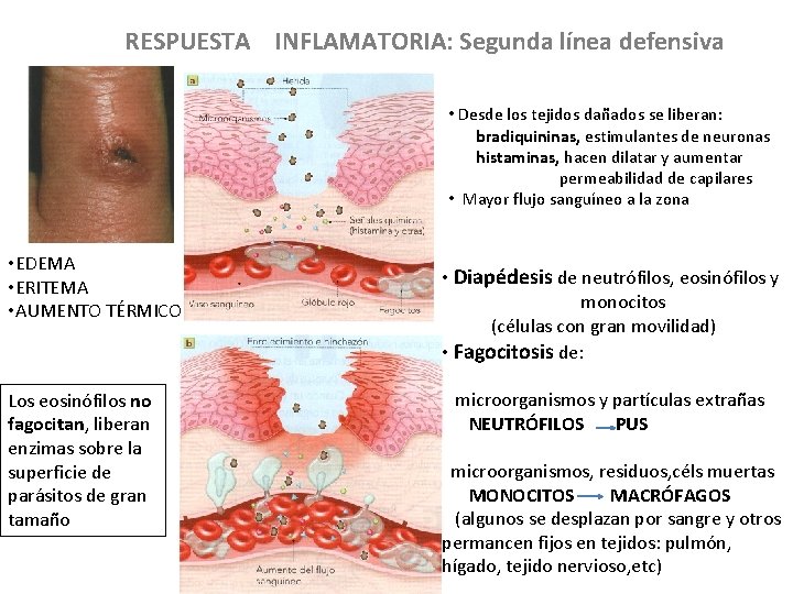 RESPUESTA INFLAMATORIA: Segunda línea defensiva • Desde los tejidos dañados se liberan: bradiquininas, estimulantes