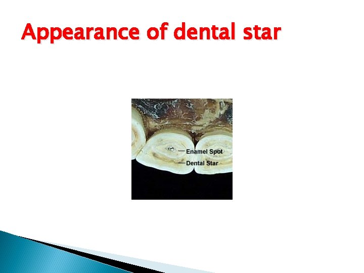 Appearance of dental star 