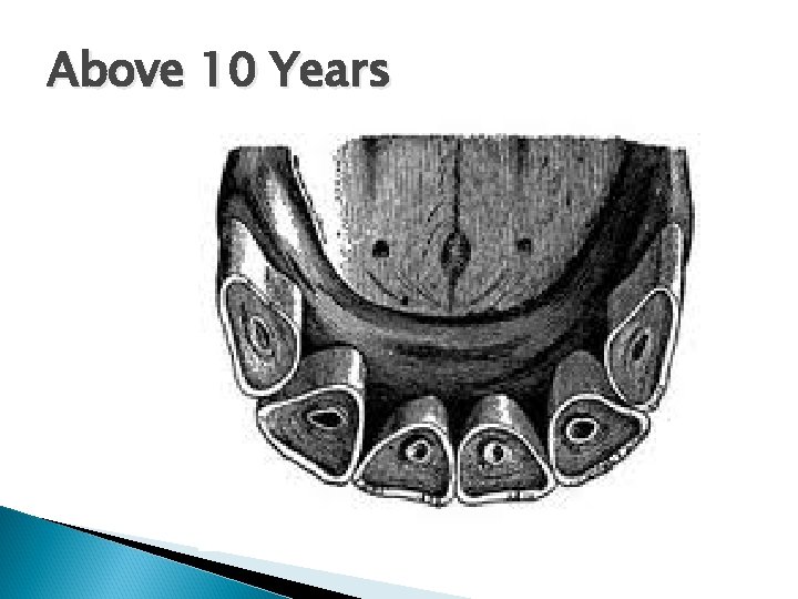 Above 10 Years 
