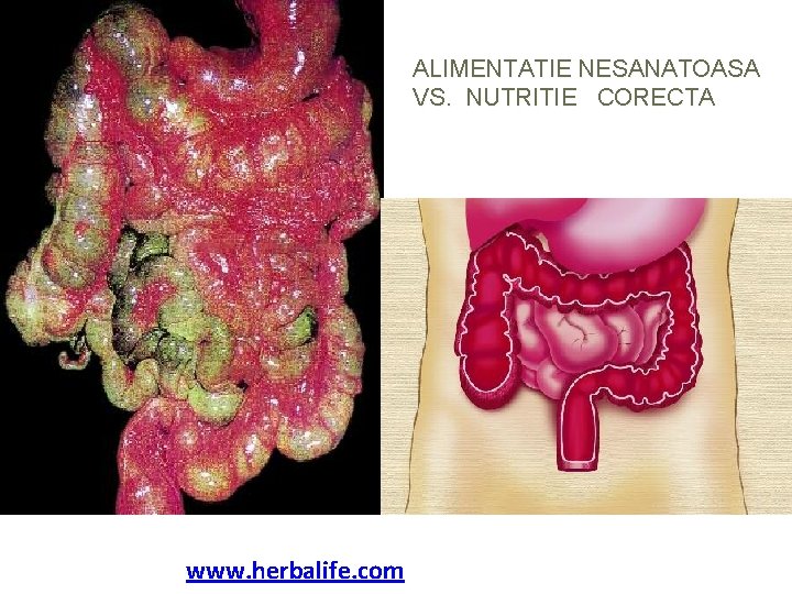 ALIMENTATIE NESANATOASA VS. NUTRITIE CORECTA www. herbalife. com 
