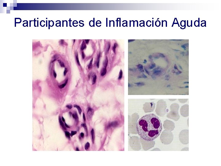 Participantes de Inflamación Aguda 