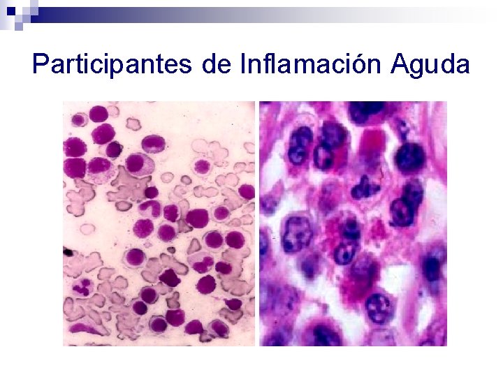 Participantes de Inflamación Aguda 