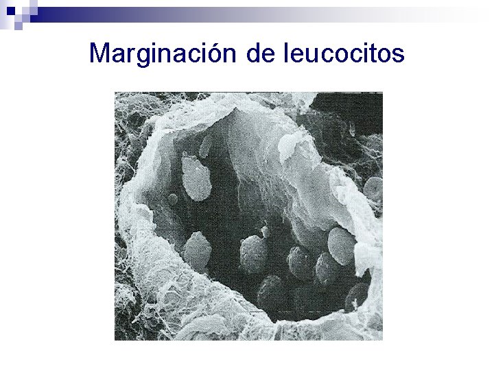 Marginación de leucocitos 