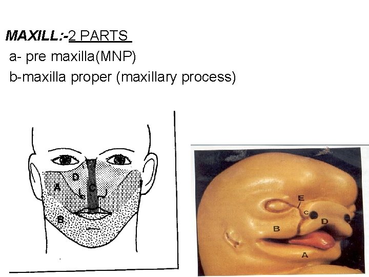 MAXILL: -2 PARTS a- pre maxilla(MNP) b-maxilla proper (maxillary process) 