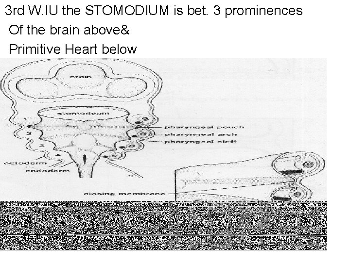 3 rd W. IU the STOMODIUM is bet. 3 prominences Of the brain above&
