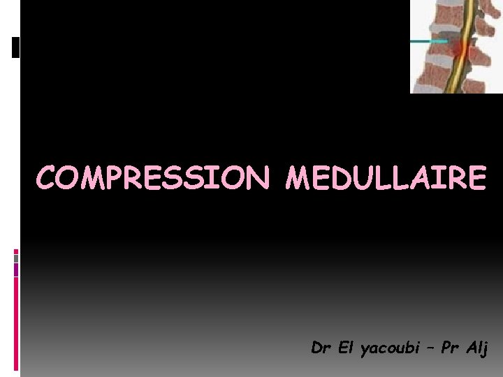 COMPRESSION MEDULLAIRE Dr El yacoubi – Pr Alj 
