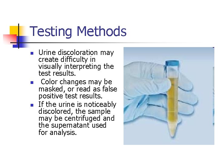 Testing Methods n n n Urine discoloration may create difficulty in visually interpreting the