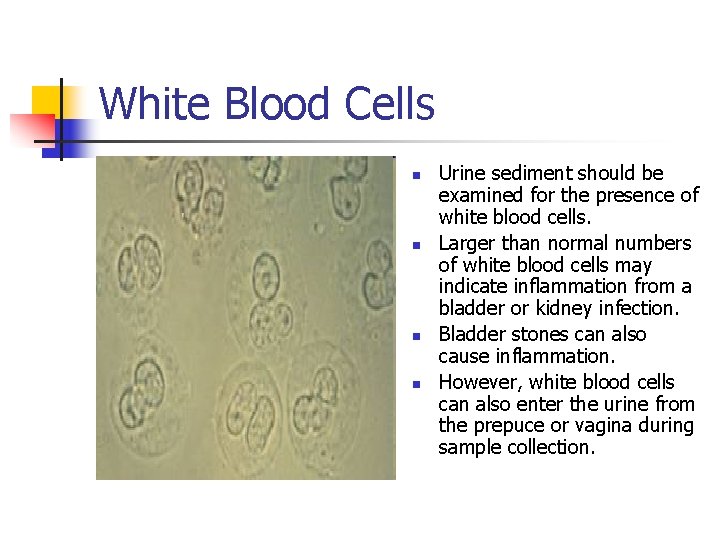 White Blood Cells n n Urine sediment should be examined for the presence of