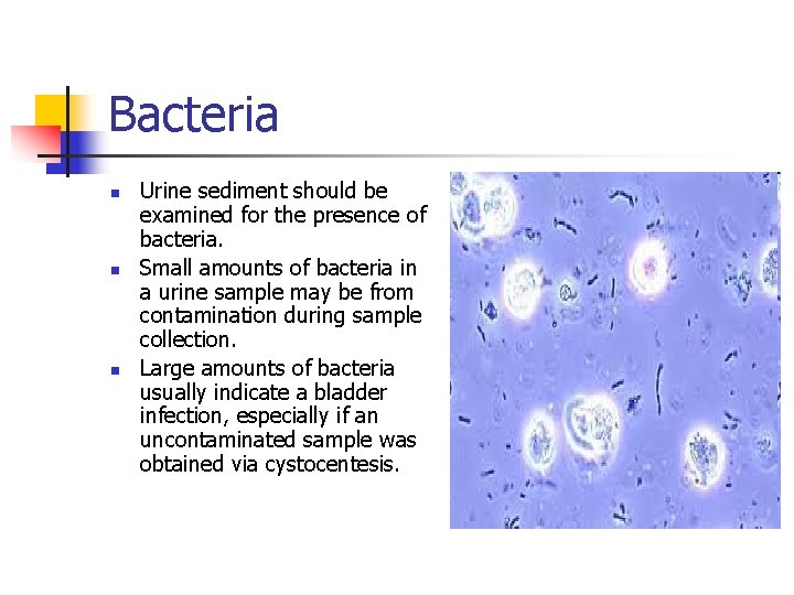 Bacteria n n n Urine sediment should be examined for the presence of bacteria.